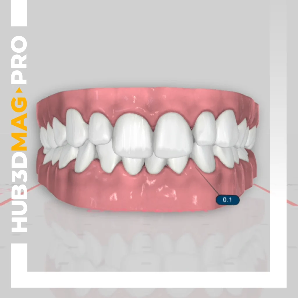 Cover Magazine PRO Titan part 2 - HUB3D Orthodontics