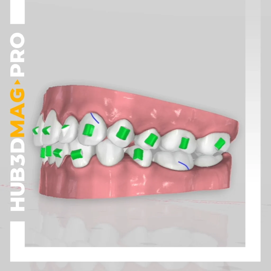Cover Magazine PRO Titan - HUB3D Orthodontics
